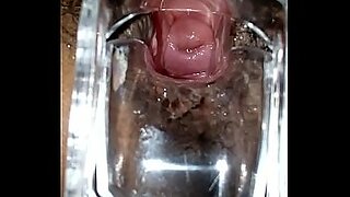 SLIM INDIAN BROWN GIRL CERVIX SPECULUM CHECK VAGINAL OPENING